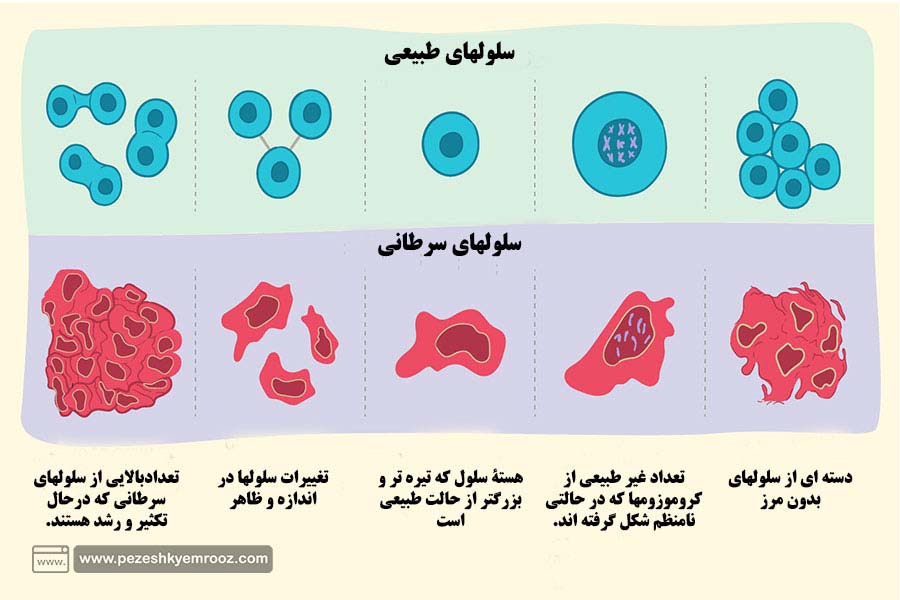 سرطان| سرطان خون| ژن| استخوان| سلول سرطانی|لوسمی حادمغز(AML) استخوان چیست